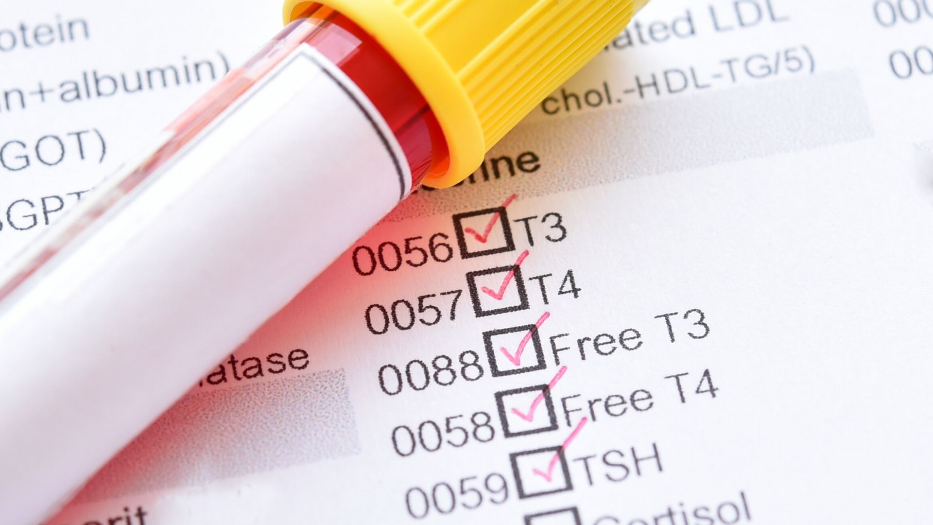 WHAT THYROID TESTS SHOULD BE DONE